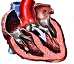 Mitraalinen aortan vika